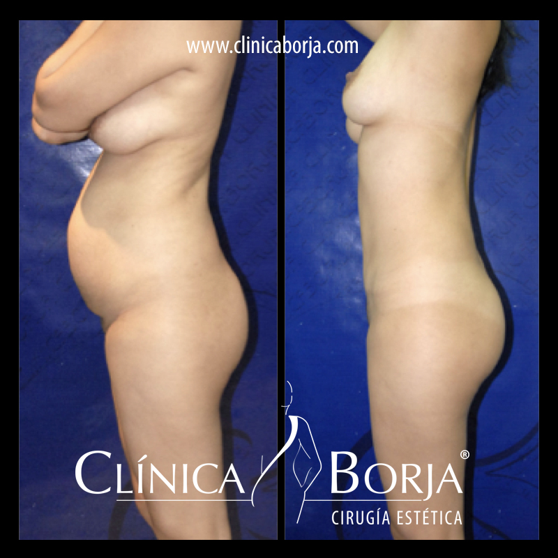 abdomen